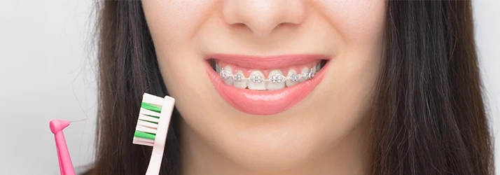 The Safest Ways to Whiten Your Teeth While Wearing Braces in Nashville TN